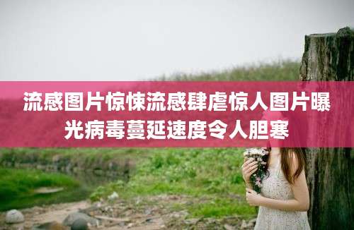 流感图片惊悚流感肆虐惊人图片曝光病毒蔓延速度令人胆寒